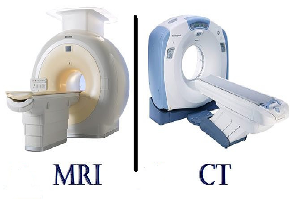 CT and MRI Scans